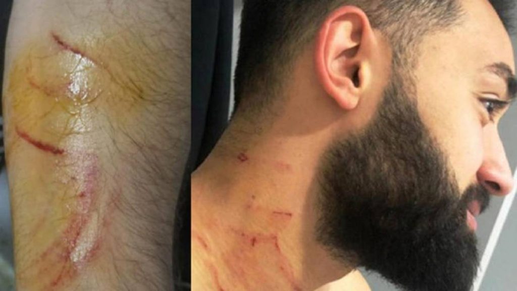 Tyrkisk spiller suspenderet på livstid efter knivstik på modstander