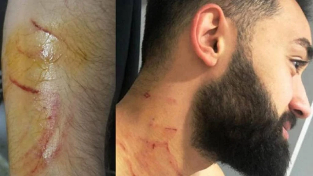 Tyrkisk spiller suspenderet på livstid efter knivstik på modstander